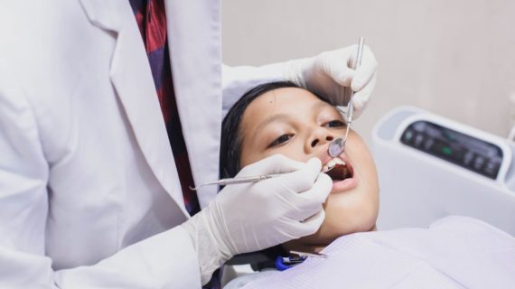 Alasan Cabut Gigi Jadi Opsi Penanganan Terakhir yang Harus Dipertimbangkan