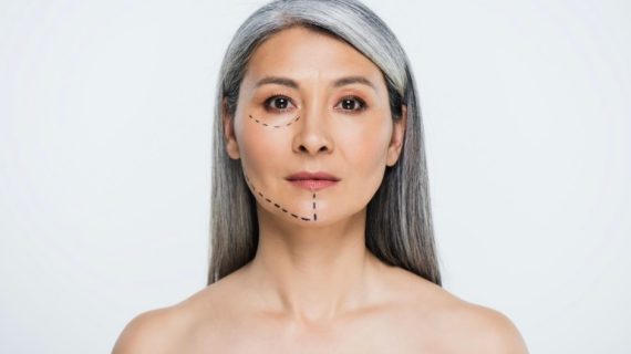 Yuk, Atasi Penuaan Dini dengan Treatment Ini di Dermacenter!