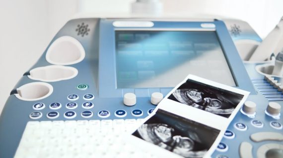 Down Syndrome Janin: Waktu Tepat Mengecek dan Rekomendasi USG Bandung untuk Pengecekan Berkualitas