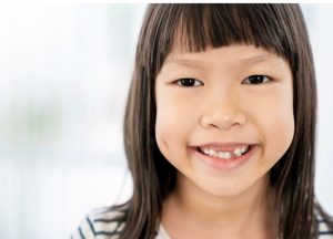 Gigi Anak