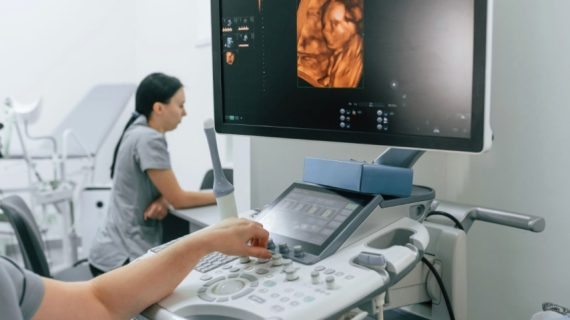 Pentingnya USG Rutin untuk Kehamilan Sehat: Tips dan Rekomendasi USG Bandung