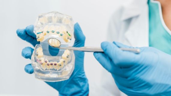 Gigi Kuning dan Bau Mulut? Ini Pilihan Treatment Serta Rekomendasi Dokter Gigi Bandung Terbaik