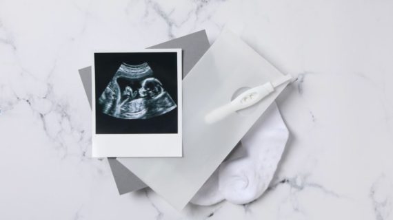 Deteksi Kelainan Kongenital Sejak Dini dengan USG