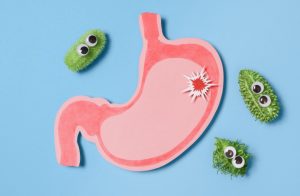 kesehatan lambung