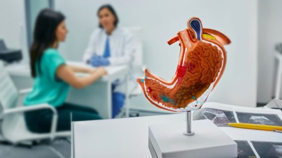 Cara Mencegah dan Meredakan Asam Lambung, Kapan Harus ke Poli Umum 24 Jam?