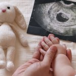 Bisakah Down Syndrome Dideteksi melalui USG 4D? Ini Penjelasannya
