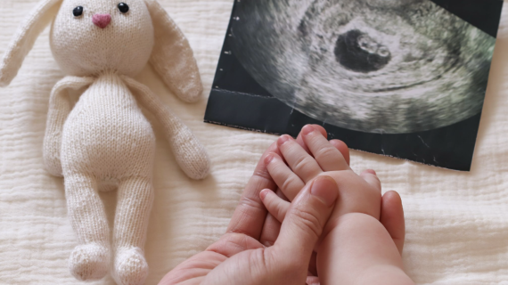 Bisakah Down Syndrome Dideteksi melalui USG 4D? Ini Penjelasannya