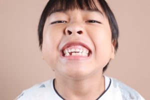 gigi anak