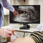 Ingin USG di Trimester 1 Kehamilan? Perhatikan 3 Hal Berikut!