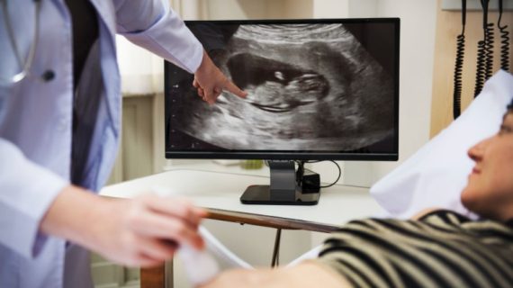 Ingin USG di Trimester 1 Kehamilan? Perhatikan 3 Hal Berikut!