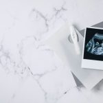Peran USG 4D dalam Tradisi Gender Reveal