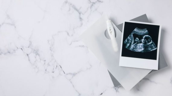Peran USG 4D dalam Tradisi Gender Reveal