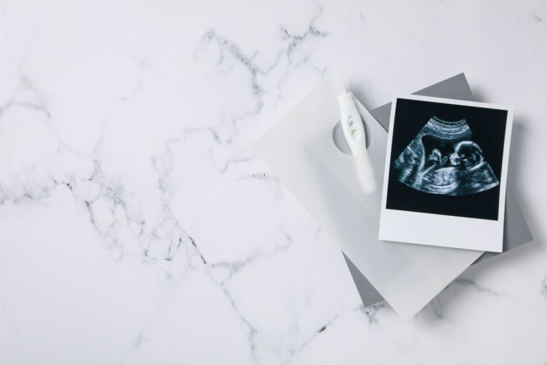 Peran USG 4D dalam Tradisi Gender Reveal