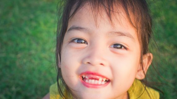gigi anak